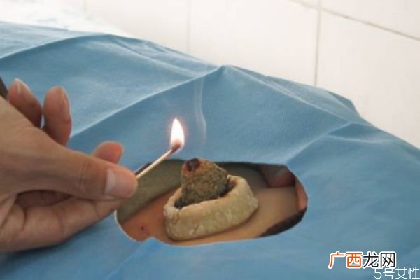 艾灸肚脐眼的功效 艾灸肚脐眼的时间