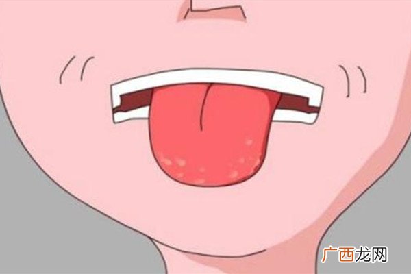 正常的舌苔是什么颜色 正常舌苔的特点