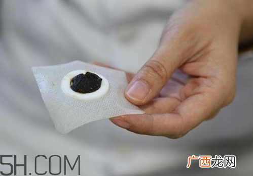 三九贴能洗澡吗 贴三九贴能洗澡吗