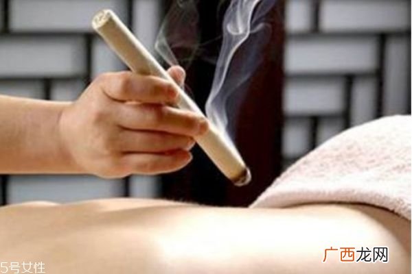 艾灸贴的功效是什么 艾灸贴可以天天贴吗