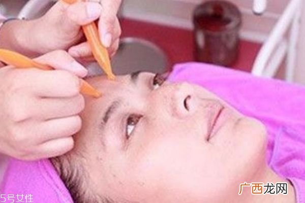 面部刮痧可以瘦脸吗 有一定的作用