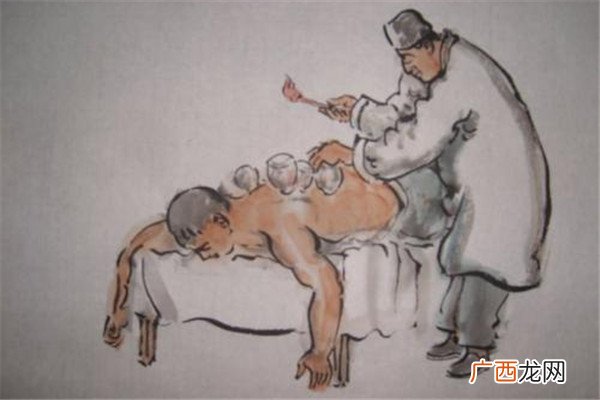 拔火罐不红是怎么回事 拔火罐为什么不红呢