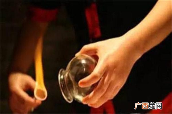拔火罐多少钱一次 拔火罐怎么收费