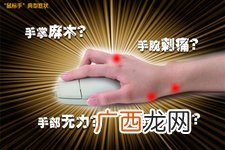 鼠标手有哪些症状 怎么治疗最有效