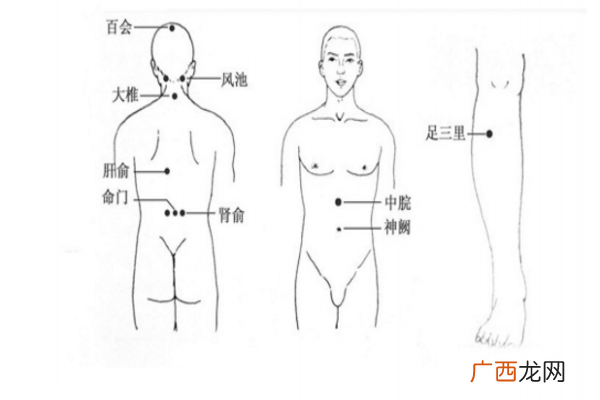 中医针灸疗法中艾灸 能有效治疗头痛症状