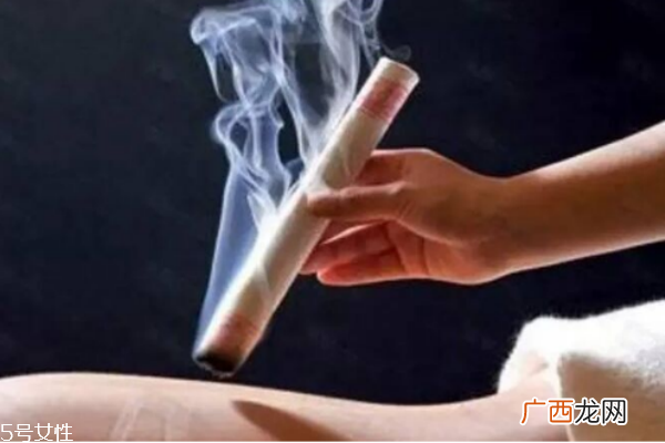 中医针灸疗法中艾灸 能有效治疗头痛症状