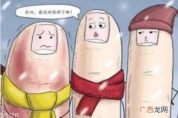 冬天脚长冻疮怎么办 脚上长冻疮要注意