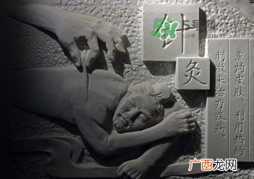 三伏天针灸有什么好处？三伏天针灸注意什么？