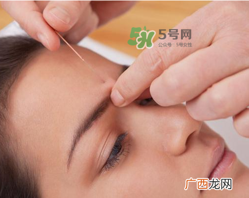 三伏天针灸有什么好处？三伏天针灸注意什么？