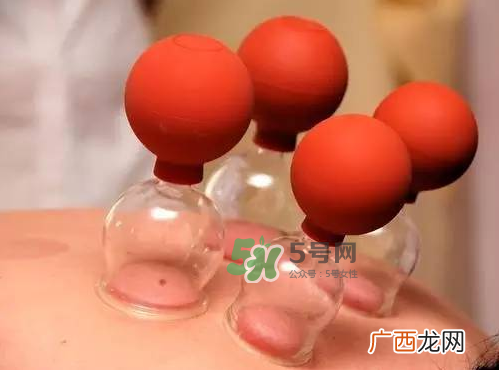 三伏天拔罐好吗？三伏天拔罐好还是艾灸好？