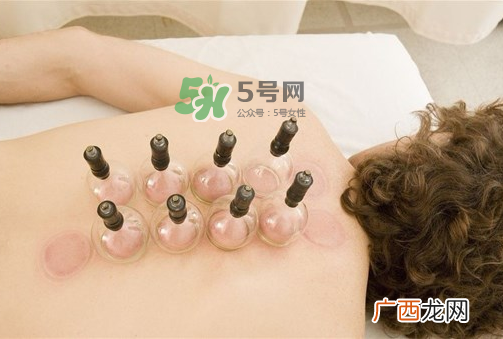 三伏天拔罐好吗？三伏天拔罐好还是艾灸好？