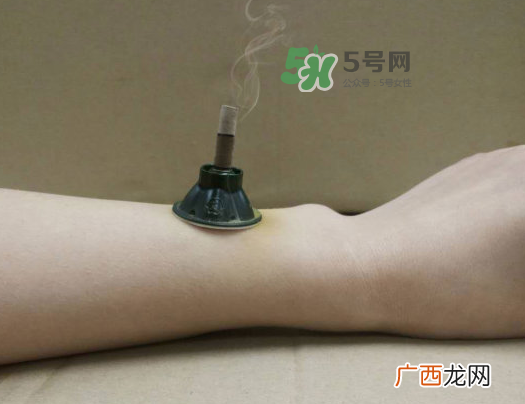 三伏天下雨可以艾灸吗？三伏天下雨艾灸好吗？