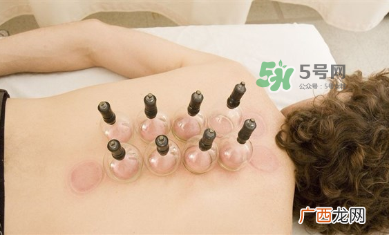 下雨天可以拔罐吗？下雨天拔罐有影响吗？