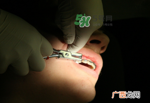 三伏天可以拔牙吗吗?三伏天拔牙好吗？