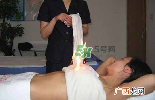 三伏天可以做火疗吗_三伏天做火疗好吗_三伏天做火疗的好处