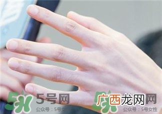 夏季为什么会手脚脱皮?小孩子夏天手脱皮是怎么回事?