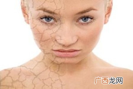 大雪即将来临容易缺水的部位及补水方法
