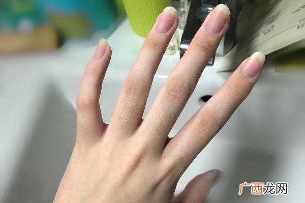 冬季如何治疗皮肤干裂?五个方法有效解决