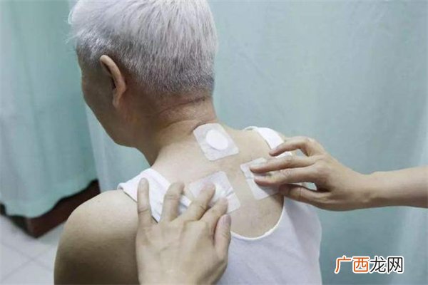 三伏贴一年四季都能贴吗 三伏贴为什么贴了感觉凉