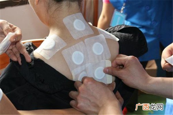 冬病夏治的原理和好处 冬病夏治三伏贴