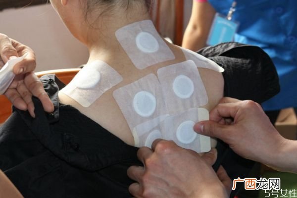 三伏贴什么时候贴最好 什么时候最适合贴三伏贴