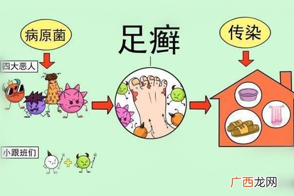 灰指甲症状是什么 原因是这样