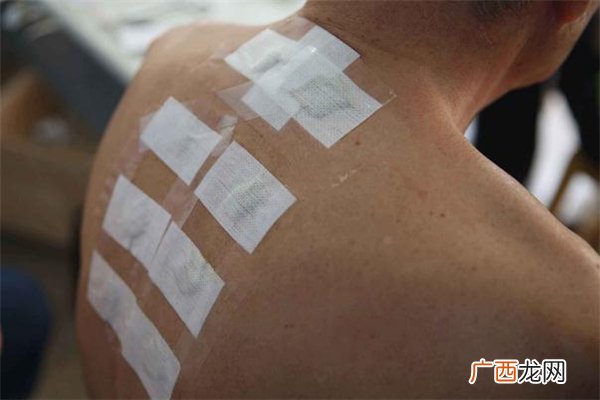 三伏贴可以提高免疫力吗 三伏贴为什么一点用也没有