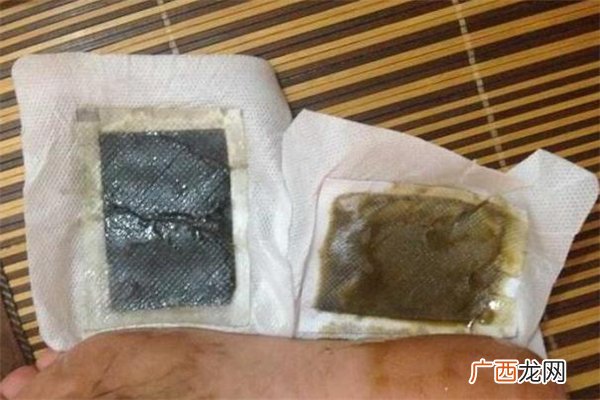 老北京足贴能减肥吗 老北京足贴能贴肚脐吗