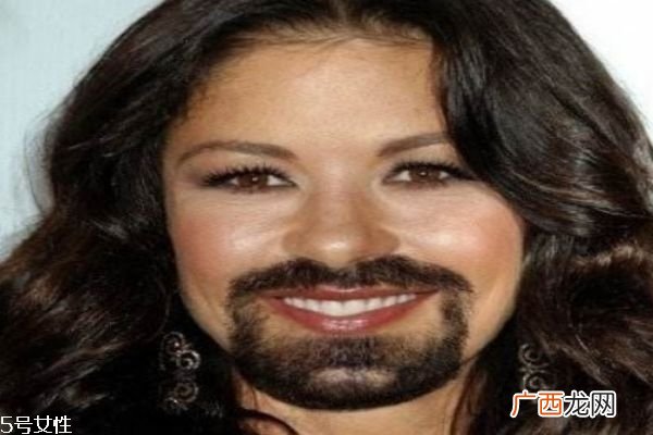 女生为什么长胡子 女生长胡子的原因