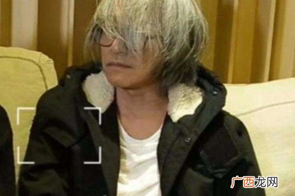 白头发可以变黑吗 头发变黑的方法