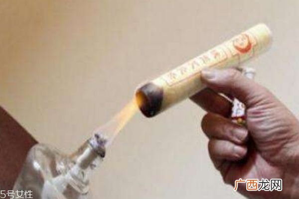 艾灸对痛经有效果吗 治疗痛经的艾灸方法
