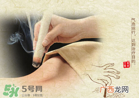 ?三伏灸和艾灸的区别_三伏灸是艾灸吗