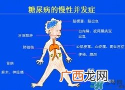 糖尿病症状 糖尿病早期症状
