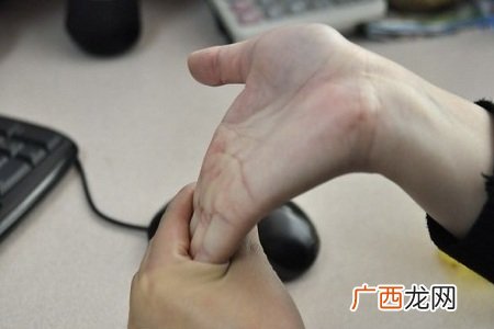 鼠标手怎么治疗?治疗“鼠标手”的保健动作