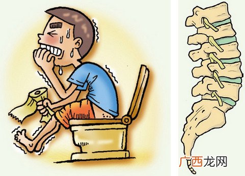 便秘的护理措施 润肠通便9大招