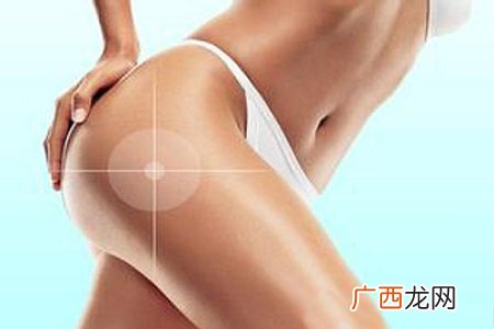 ?摆脱松懈臀部的保健小妙招