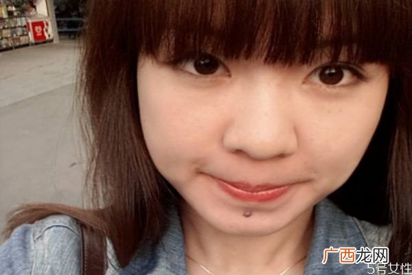 脸部的长的痣可以去掉吗 脸部的痣有什么讲究吗