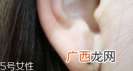 打耳洞必须注意哪些事？耳垂小不要打