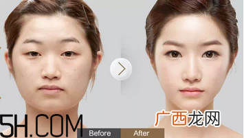 女性常贴双眼皮有哪些危害？女性该怎么保养眼部？