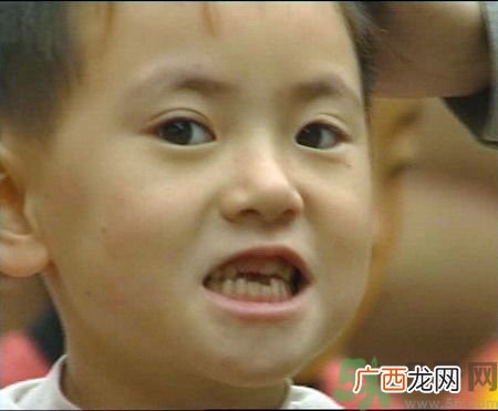 小孩子铅中毒症状是什么？怎么预防小孩子铅中毒？
