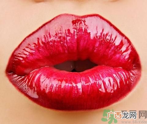 嘴里有溃疡怎么办？口腔溃疡吃什么好？
