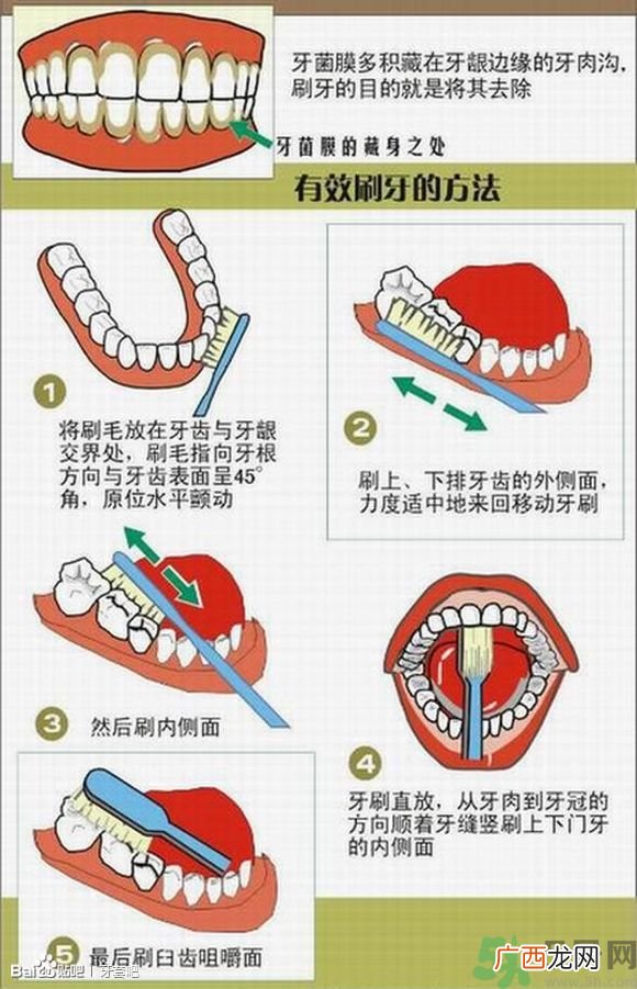 18岁还能戴牙套吗？戴牙套真的能瘦脸改变脸型吗？