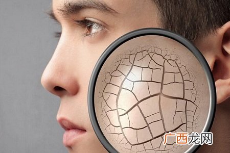 冬季男性护肤应该怎么做最有效