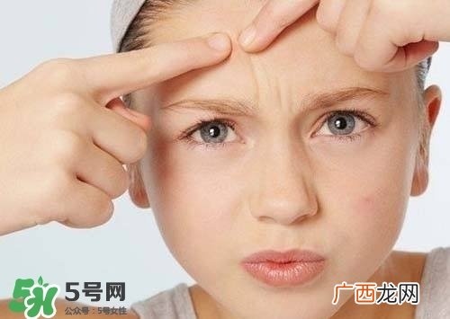 痘印怎么去除 痘印怎么祛除小妙招