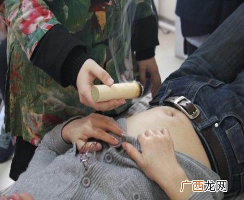 艾灸的起源与疗效,艾灸的发源地是哪里