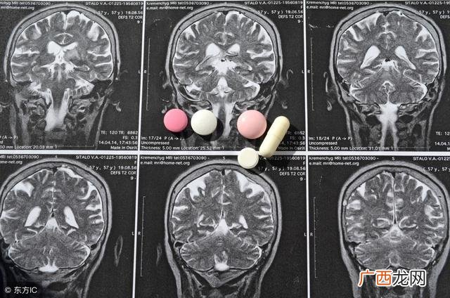 丘脑出血后遗症有哪些,脑出血后创业