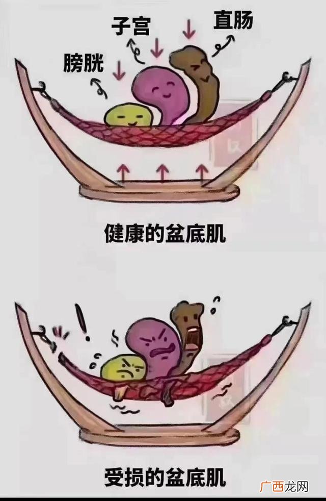 产后发汗有必要吗 产后恢复必做项目