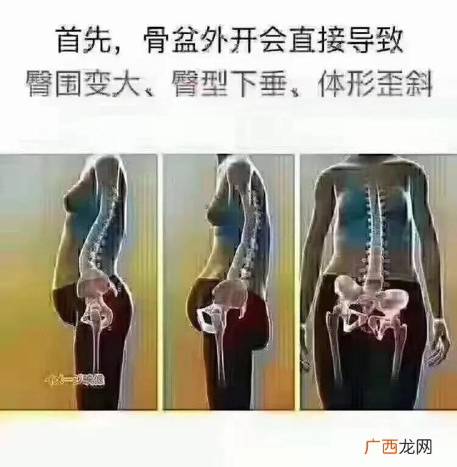 产后发汗有必要吗 产后恢复必做项目