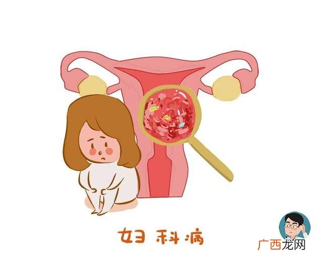 子宫脱垂二度怀孕了该怎么办,顺产后子宫脱垂是什么感觉