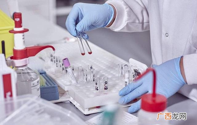 女性查性激素6项挂什么科,女性性激素六项挂什么科